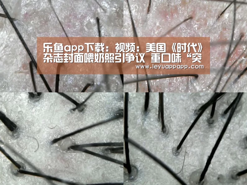 乐鱼app下载:视频:美国《时代》杂志封面喂奶照引争议 重口味“突破尺度”(图3) 乐鱼app下载